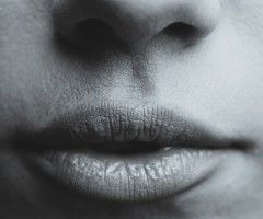 Modelowanie ust kwasem hialuronowym